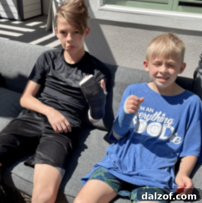 Humorous photo of two boys with arm casts, representing a funny family moment.